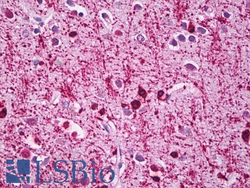 IHC-plus™ CRYAB / Alpha B Crystallin Antibody