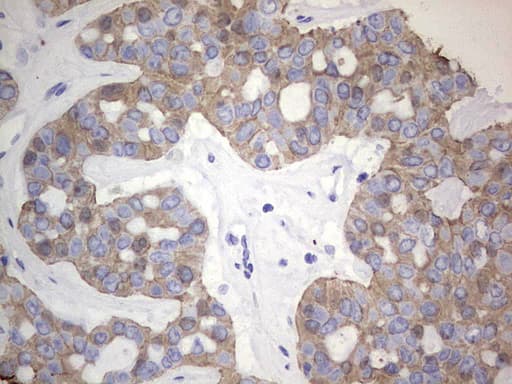 Acidic Cytokeratin Antibody (clone 8A3)