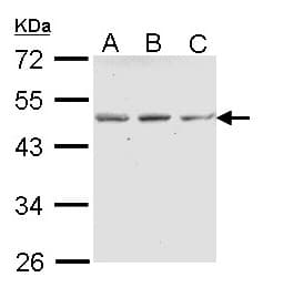 IHC-plus™ Polyclonal Rabbit anti-Human ENTPD5 / CD39L4 Antibody (IHC, WB)
