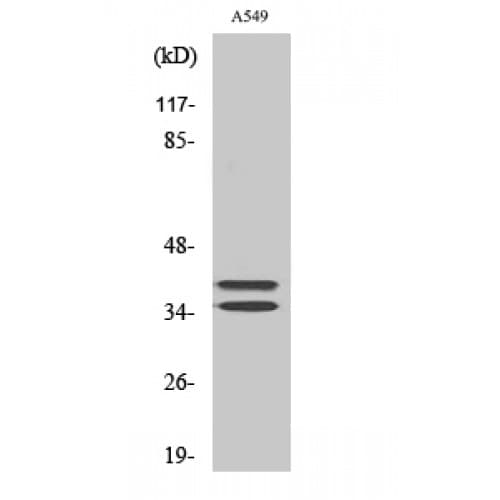 LAT Antibody (160-240 aa)