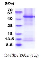 Human ENTPD6 Protein (Recombinant His)