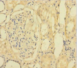 PLA2G2D Antibody