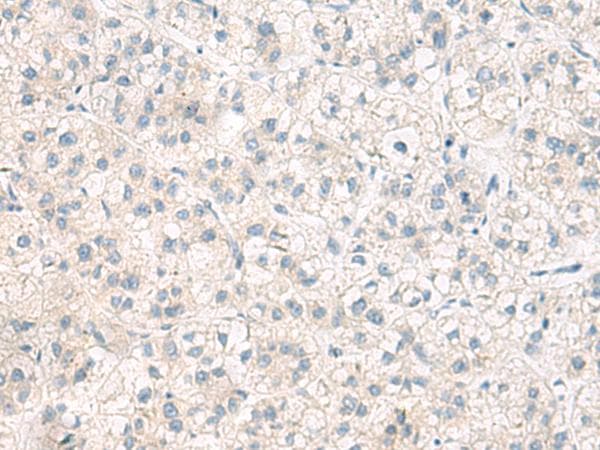 ANKS6 Antibody
