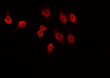 Polyclonal Rabbit anti-Human HMG20B / BRAF35 Antibody (IF, WB)