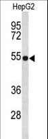 Polyclonal Rabbit anti-Human FBLN4 / EFEMP2 Antibody (aa386-414, WB)