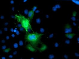 Monoclonal Mouse anti-Human PRMT2 Antibody (clone OTI3B3, IF, WB)