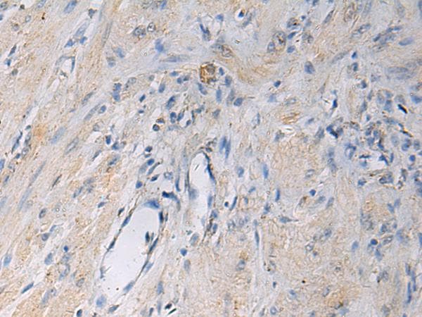 HSDL2 Antibody