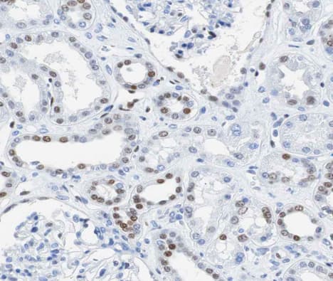 AKAP8 / AKAP95 Antibody