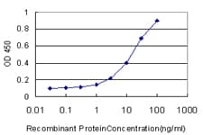 NOP16 Antibody (clone 1G4)