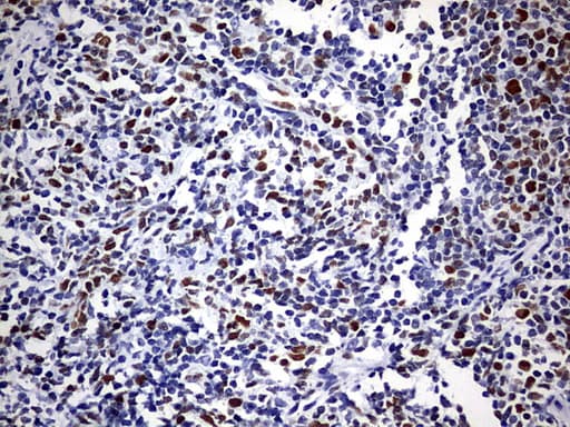 EZH2 Antibody (aa182-431, clone OTI2B10)