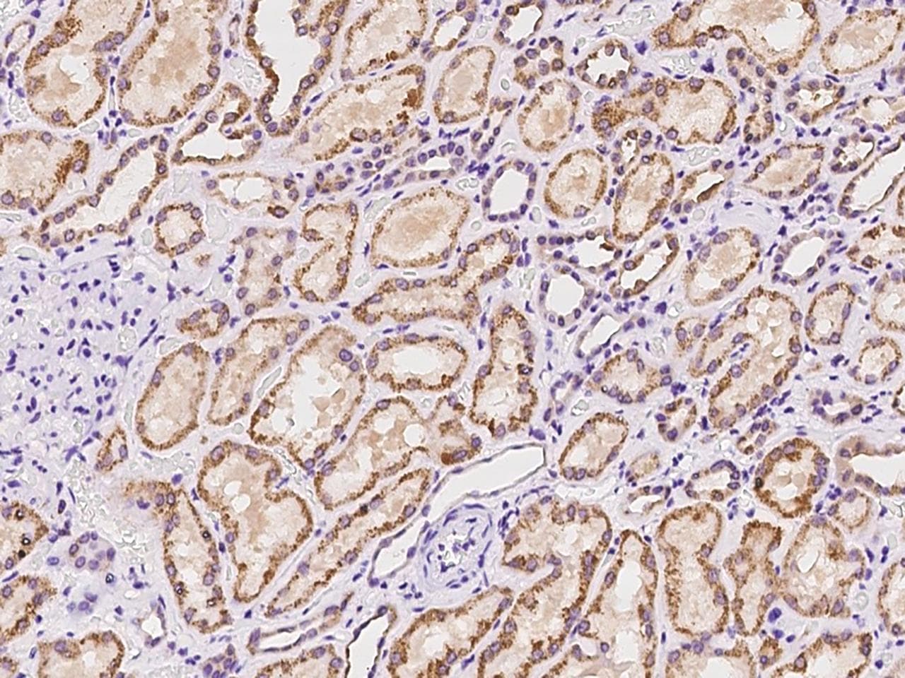 ADAT1 Antibody