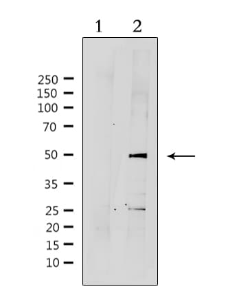 Polyclonal Rabbit anti-Human SUV39H2 Antibody (IF, WB)