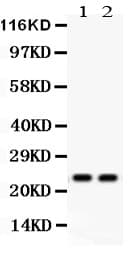 MAD2L1 / MAD2 Antibody (aa2-205)