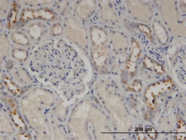 CALML5 Antibody (clone 2F10)