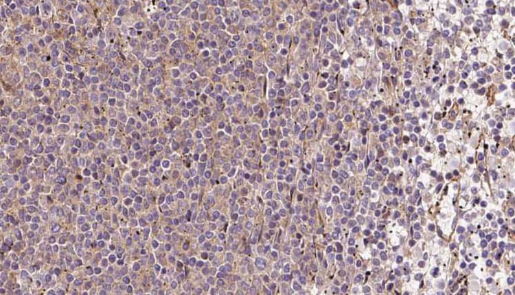 COQ9 Antibody