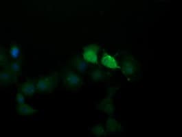 SOLO / SESTD1 Antibody (clone OTI7G4)