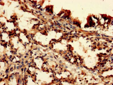 DAP Antibody