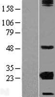 CRYBA2 Protein (Over-Expression Lysate Myc-DDK (Flag))
