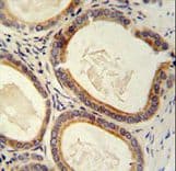 TRAM2 Antibody (aa342-370)