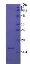 Human TGFB1 / TGF Beta 1 Protein (Recombinant His, N-Terminal)