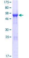 Human RWDD2A Protein (Recombinant GST)
