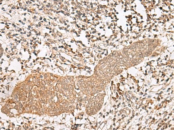 Polyclonal Rabbit anti-Human FGF13 Antibody (IHC)