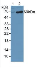 DBH/Dopamine Beta Hydroxylase Antibody (aa335-571)