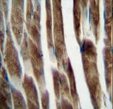 ILKAP Antibody (aa243-270)