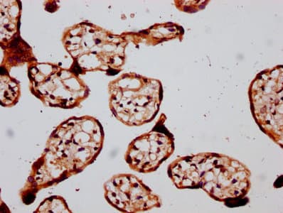 GATAD2B Antibody