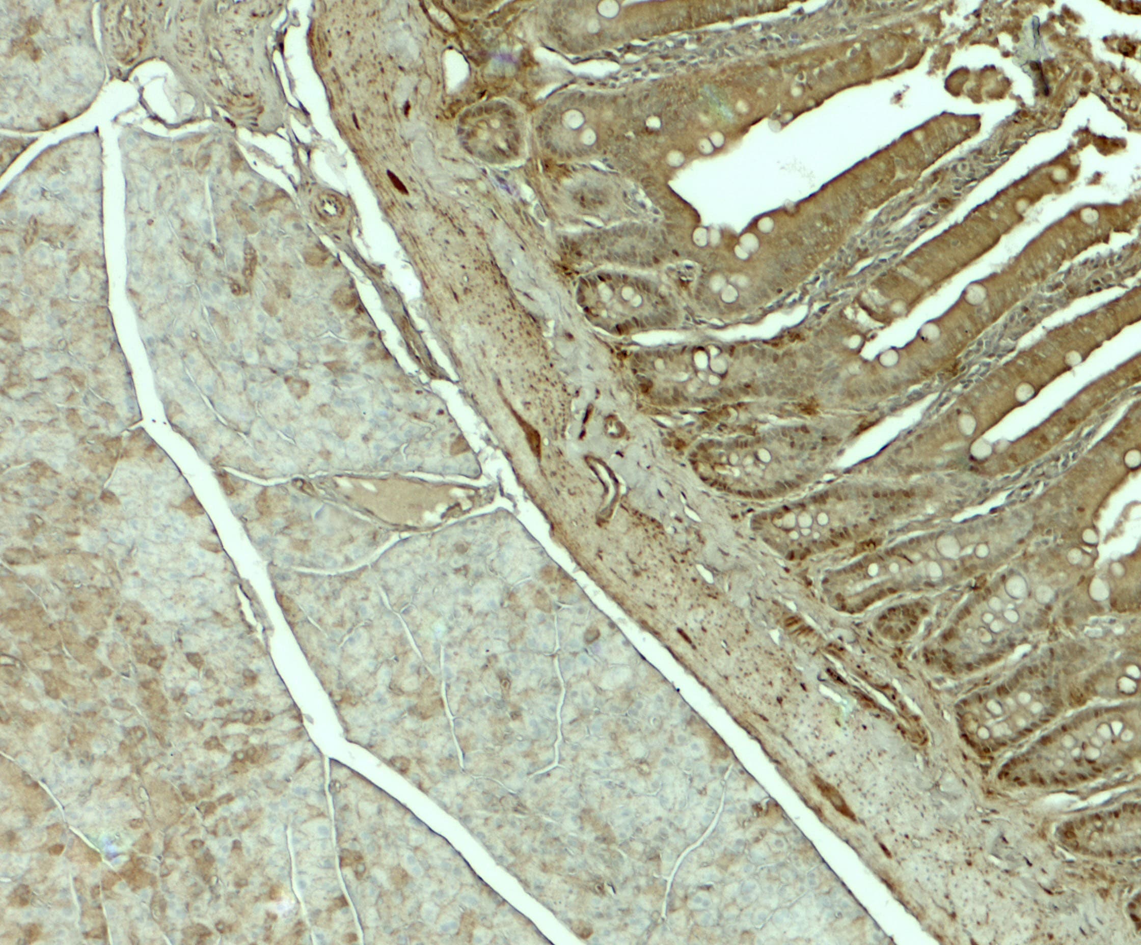 IHC-plus™ SLC29A3 / ENT3 Antibody