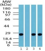 UCHL1 / PGP9.5 Antibody (aa100-150)