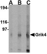 IHC-plus™ GRIK4 / KA1 Antibody