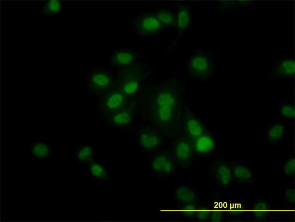 IHC-plus™ Monoclonal Mouse anti-Human HDAC1 Antibody (clone 5C11, IHC, IF, WB)