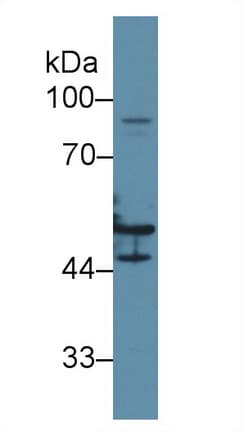 KRT16 / CK16 / Cytokeratin 16 Antibody (aa117-419, FITC)