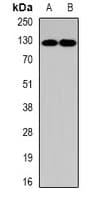 PUM1 Antibody