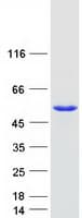 Human TDP2 / TTRAP Protein (Recombinant Myc-DDK (Flag))