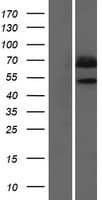 PIP5K1B Protein (Over-Expression Lysate Myc-DDK (Flag))