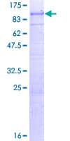 Human FARP2 / FRG Protein (Recombinant GST)
