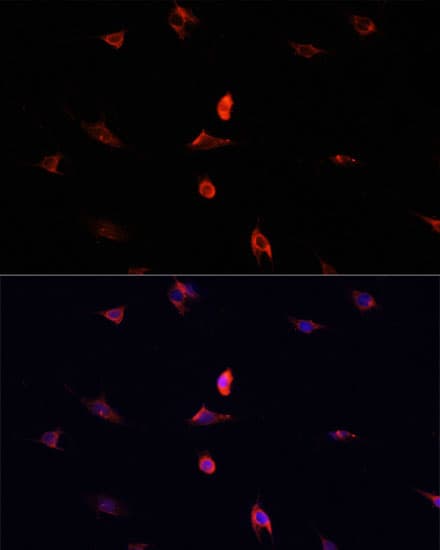 CD4 Antibody