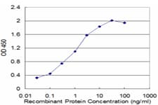 CTDP1 / FCP1 Antibody (clone 3G4)