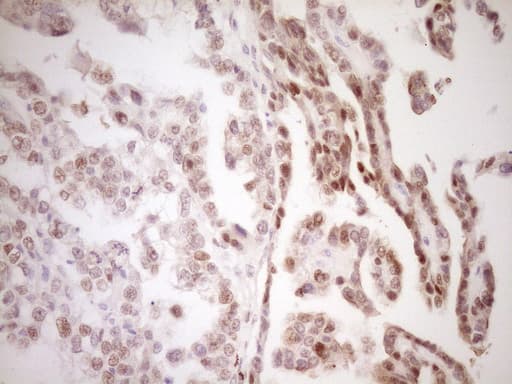 TFPI / LACI Antibody (aa29-304, clone OTI5H5)