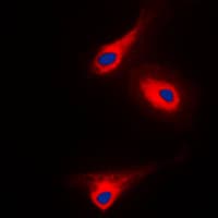 Polyclonal Rabbit anti-Human PLCG1 Antibody (phospho-Tyr1253, IF, WB)