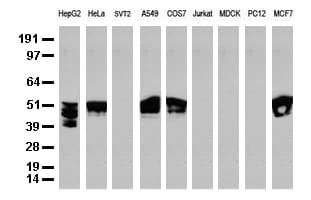 KRT8 / CK8 / Cytokeratin 8 Antibody (aa91-381, clone UMAB1)