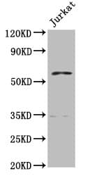 PCCB Antibody