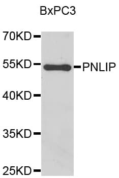 Polyclonal Rabbit anti-Human PNLIP / PL / Pancreatic Lipase Antibody (IHC, IF, WB)