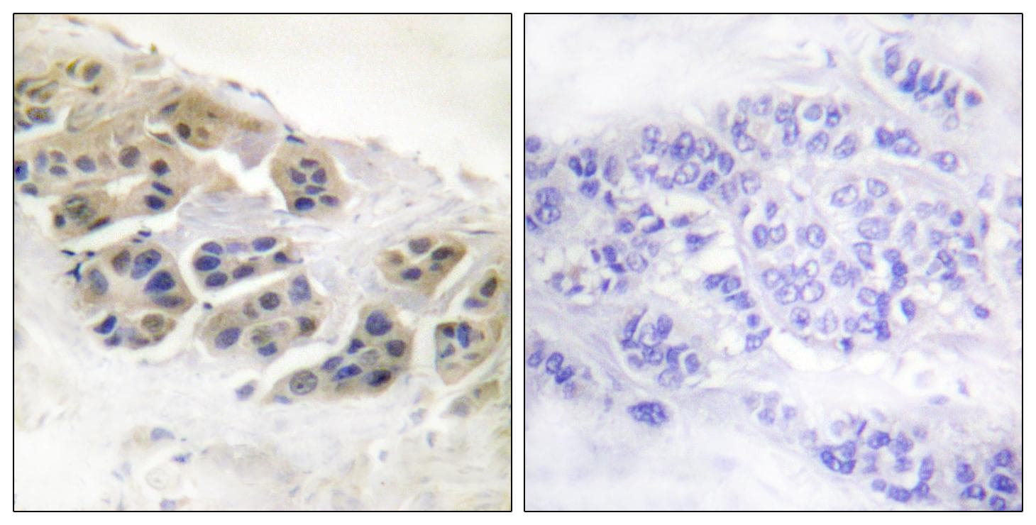SCGB2A2 / Mammaglobin A Antibody