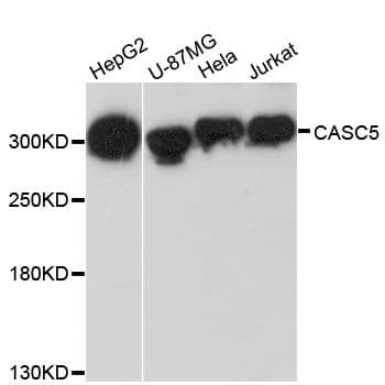Polyclonal Rabbit anti-Human CASC5 Antibody (WB)