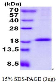 Human CD79B / CD79 Beta Protein (Recombinant His)