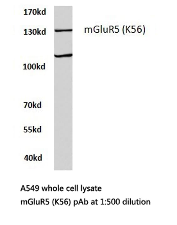Polyclonal Rabbit anti-Human GRM5 / MGLUR5 Antibody (Lys56, IHC, IF, WB)