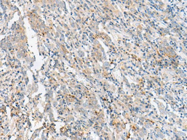 CTRB1 / Chymotrypsinogen B1 Antibody